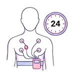 Monitoramento Eletrocardiográfico (Holter 24h)