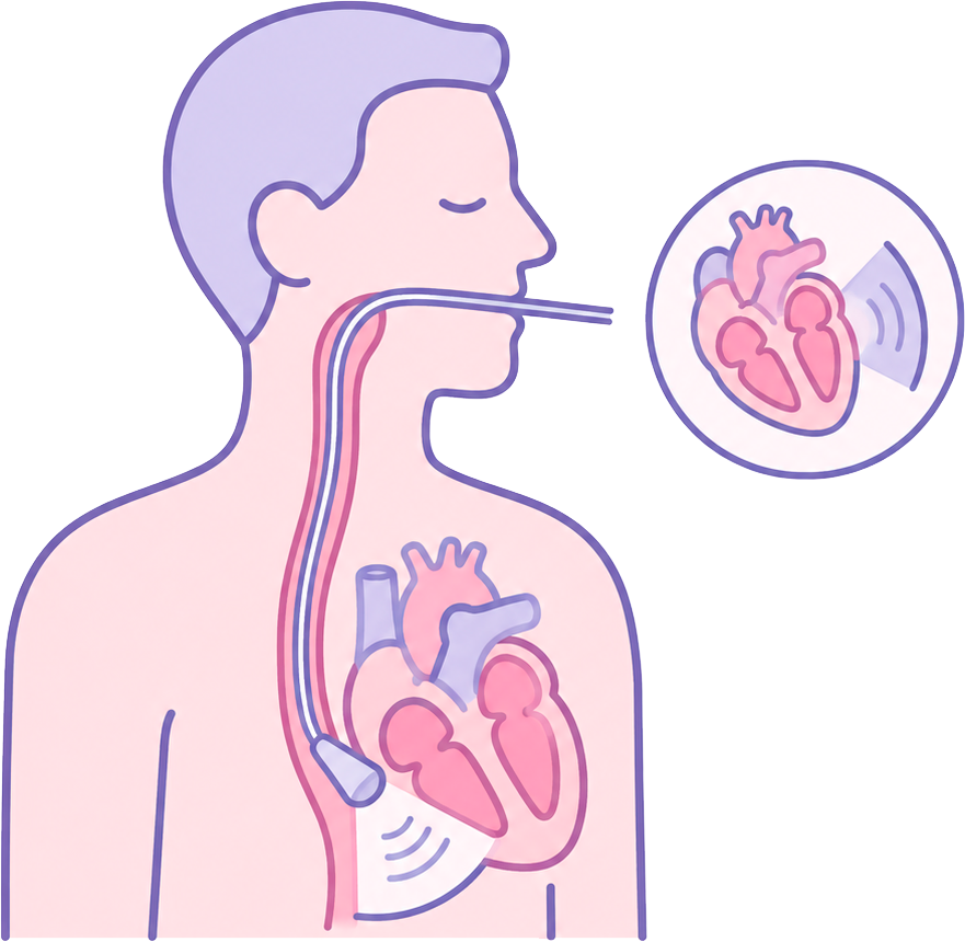 Ecocardiograma Transesofágico
