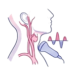 EcoDoppler Arterial de Carótidas e Vertebrais